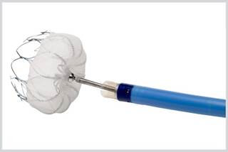 First-of-Kind Implant to Reduce Stroke in High-Risk Patients Approved First-of-Kind Implant to Reduce Stroke in High-Risk Patients Approved