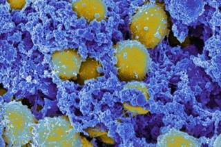 Could Bacteria Cause Type 2 Diabetes Development? Could Bacteria Cause Type 2 Diabetes Development?