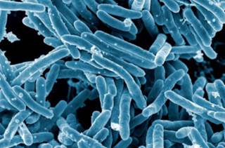 Patient With Extensively Drug-Resistant TB May Have Exposed Hundreds Patient With Extensively Drug-Resistant TB May Have Exposed Hundreds