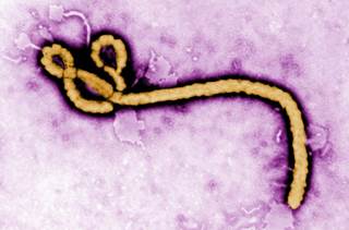 Ebola Virus Can Persist Up to Nine Months in Semen of Survivors Ebola Virus Can Persist Up to Nine Months in Semen of Survivors