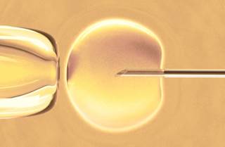 Women undergoing mini-IVF have no ovarian hyperstimulation Women undergoing mini-IVF have no ovarian hyperstimulation