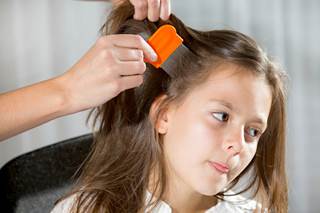 Guidelines Updated for Lice Infestation Among Children Guidelines Updated for Lice Infestation Among Children