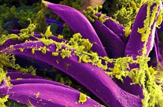 Second Plague Death Confirmed in Colorado Second Plague Death Confirmed in Colorado