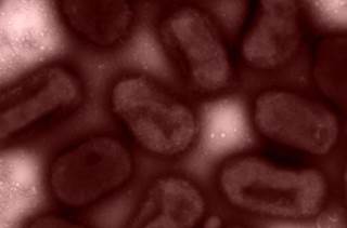 New Discovery Shows Superbugs May Be Built for Self-Destruction New Discovery Shows Superbugs May Be Built for Self-Destruction