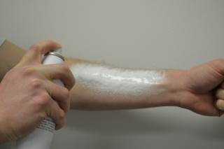 Hemogrip Patch Forms 3D Mesh to Control Bleeding Hemogrip Patch Forms 3D Mesh to Control Bleeding