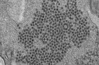 Compared to Other Viruses, EV-D68 May Have Similar Mortality Risk in Children Compared to Other Viruses, EV-D68 May Have Similar Mortality Risk in Children