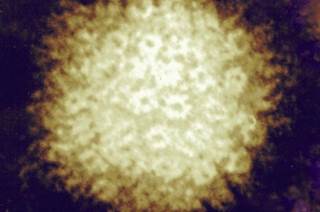 Fewer Chickenpox Cases Today, Even Among the Non-immunized Fewer Chickenpox Cases Today, Even Among the Non-immunized