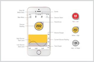 Fully Mobile Continuous Glucose Monitoring System Approved Fully Mobile Continuous Glucose Monitoring System Approved