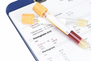 Benefits of SGLT-2 Inhibitors Go Beyond Glycemic Control Benefits of SGLT-2 Inhibitors Go Beyond Glycemic Control