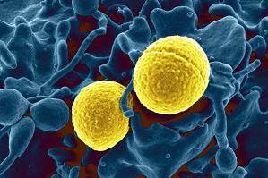 Some Pediatric Cellulitis Successfully Treated at Home, Study Suggests Some Pediatric Cellulitis Successfully Treated at Home, Study Suggests