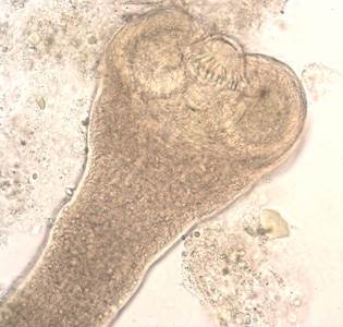 Tapeworm May Have Transmitted Cancer Cells to Patient, Says CDC Tapeworm May Have Transmitted Cancer Cells to Patient, Says CDC