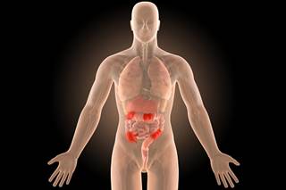 79 patients with prior cancers who received anti-TNF therapy were examined by the authors 79 patients with prior cancers who received anti-TNF therapy were examined by the authors