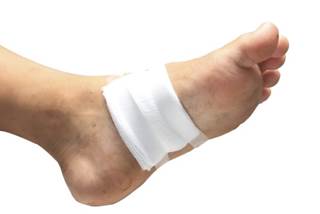 HBOT does not reduce indications for amputation or facilitate wound healing HBOT does not reduce indications for amputation or facilitate wound healing