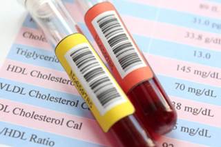 Nonpharmacologic and pharmacologic approaches to hypertriglyceridemia Nonpharmacologic and pharmacologic approaches to hypertriglyceridemia