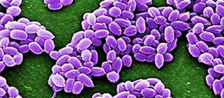 The treatment blocks entry of anthrax toxin into susceptible cells The treatment blocks entry of anthrax toxin into susceptible cells