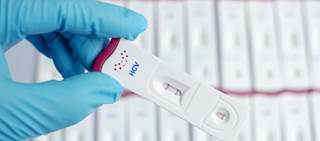 Six weeks of treatment achieved a 100% SVR, in the study sample Six weeks of treatment achieved a 100% SVR, in the study sample