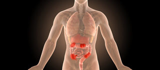 The study assessed filgotinib vs. placebo for 10 weeks in 174 patients The study assessed filgotinib vs. placebo for 10 weeks in 174 patients