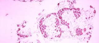 The company is currently evaluating the drug in a Phase 1 trial for the treatment of DMD in the U.S. The company is currently evaluating the drug in a Phase 1 trial for the treatment of DMD in the U.S.