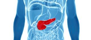 PDAC patients taking metformin had a lower risk of mortality compared to those taking other hypoglycemic meds PDAC patients taking metformin had a lower risk of mortality compared to those taking other hypoglycemic meds