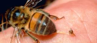 Case report describes similar HE findings for live bee sting, foreign materials in patient Case report describes similar HE findings for live bee sting, foreign materials in patient