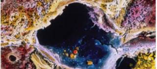CDC notes that nearly 20,000 Americans died in 2014 from hepatitis C infection CDC notes that nearly 20,000 Americans died in 2014 from hepatitis C infection