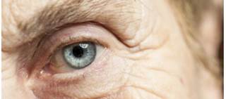 Promising Phase 3 data for Roclatan in lowering intraocular pressure Promising Phase 3 data for Roclatan in lowering intraocular pressure