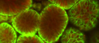 Two studies show variant carriers have better lipid levels, lower likelihood of coronary artery disease Two studies show variant carriers have better lipid levels, lower likelihood of coronary artery disease