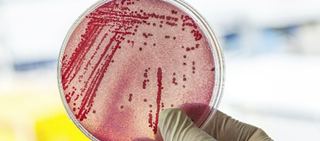 High Success Rates for Ceftaroline Fosamil for Gram-Positive Bacteremia High Success Rates for Ceftaroline Fosamil for Gram-Positive Bacteremia