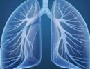 Anti-Fibrotic Drug Gets Orphan Drug Status for Idiopathic Pulmonary Fibrosis Anti-Fibrotic Drug Gets Orphan Drug Status for Idiopathic Pulmonary Fibrosis