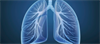 FDA Panel Votes on Therapy for Nontuberculous Mycobacterial Lung Disease FDA Panel Votes on Therapy for Nontuberculous Mycobacterial Lung Disease