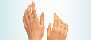 Patients undergoing electroacupuncture reported less disability and less severe symptoms Patients undergoing electroacupuncture reported less disability and less severe symptoms