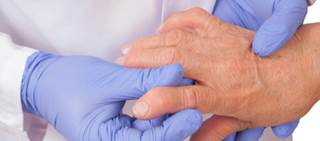 Risk attenuated with combination of prednisone and methotrexate Risk attenuated with combination of prednisone and methotrexate