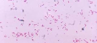Researchers analyzed the number of cures, all-cause mortality, and adverse events tied to different regimes Researchers analyzed the number of cures, all-cause mortality, and adverse events tied to different regimes