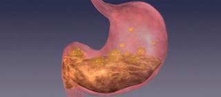 The research included a total of 82 RCTs that had a total of 125,053 patients The research included a total of 82 RCTs that had a total of 125,053 patients