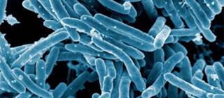 Grade B recommendation issued in draft recommendation statement on latent TB infection Grade B recommendation issued in draft recommendation statement on latent TB infection