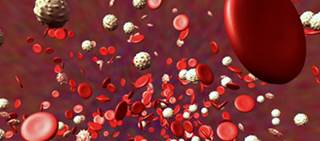 Findings in young adults with Philadelphia chromosome-negative acute lymphoblastic leukemia Findings in young adults with Philadelphia chromosome-negative acute lymphoblastic leukemia