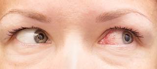 Pilot study shows ω-3 EFA supplementation is neuroprotective in patients with dry eye disease Pilot study shows ω-3 EFA supplementation is neuroprotective in patients with dry eye disease