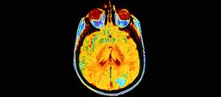Brain Scan Brain Scan