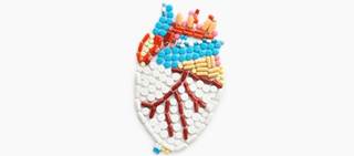 Reduction in all-cause mortality, but not hospitalization, regardless of pattern, burden of a-fib Reduction in all-cause mortality, but not hospitalization, regardless of pattern, burden of a-fib