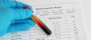 Laboratory testing revealed elevated liver enzymes which were initially attributed to amiodarone and atorvastatin. Laboratory testing revealed elevated liver enzymes which were initially attributed to amiodarone and atorvastatin.