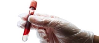Results showed that icosapent ethyl significantly reduced TGs (–22%; P<0.0001) compared with placebo Results showed that icosapent ethyl significantly reduced TGs (–22%; P<0.0001) compared with placebo