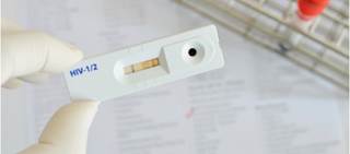 Data from 21 jurisdictions show higher percentages with negative HIV test 12 months before diagnosis Data from 21 jurisdictions show higher percentages with negative HIV test 12 months before diagnosis