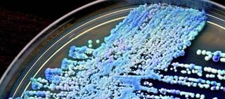 Schizophrenia patients 63% more likely to suffer serious infection than the general population Schizophrenia patients 63% more likely to suffer serious infection than the general population