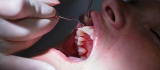 Besides gum health, researchers assessed lung function, risk factors for heart disease, diabetes Besides gum health, researchers assessed lung function, risk factors for heart disease, diabetes