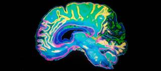 Sudden blood pressure drops may lead to hypoxia, with detrimental effects on brain tissue Sudden blood pressure drops may lead to hypoxia, with detrimental effects on brain tissue