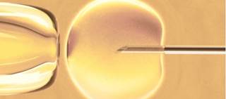 Women who had seven or more IVF cycles had lower risk for breast cancer Women who had seven or more IVF cycles had lower risk for breast cancer