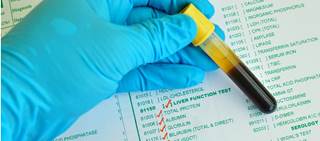 Tesamorelin is a synthetic analogue of human growth hormone-releasing hormone Tesamorelin is a synthetic analogue of human growth hormone-releasing hormone