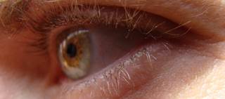 Early and late age-related macular degeneration tied to worse VSF for Chinese, not Indian, Malay adults Early and late age-related macular degeneration tied to worse VSF for Chinese, not Indian, Malay adults