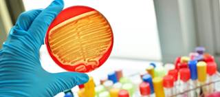 Resistance to antimicrobial drugs up in all shigellosis clusters among men who have sex with men Resistance to antimicrobial drugs up in all shigellosis clusters among men who have sex with men