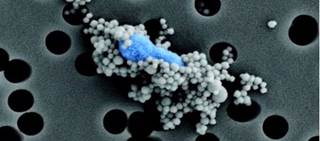 Presence of bacteria is associated with higher neuroinflammatory markers in mice, humans Presence of bacteria is associated with higher neuroinflammatory markers in mice, humans